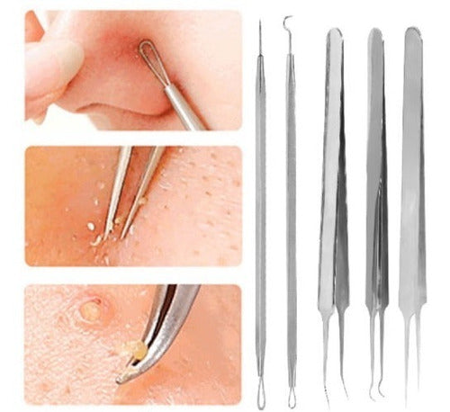 Extractor Tool System for Blackhead Removal 0