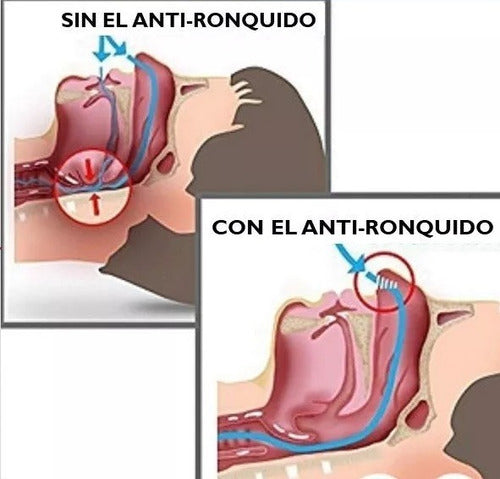 Dilatador Nasal - Conico De Silicona - Antironquido - Tamaño M 3